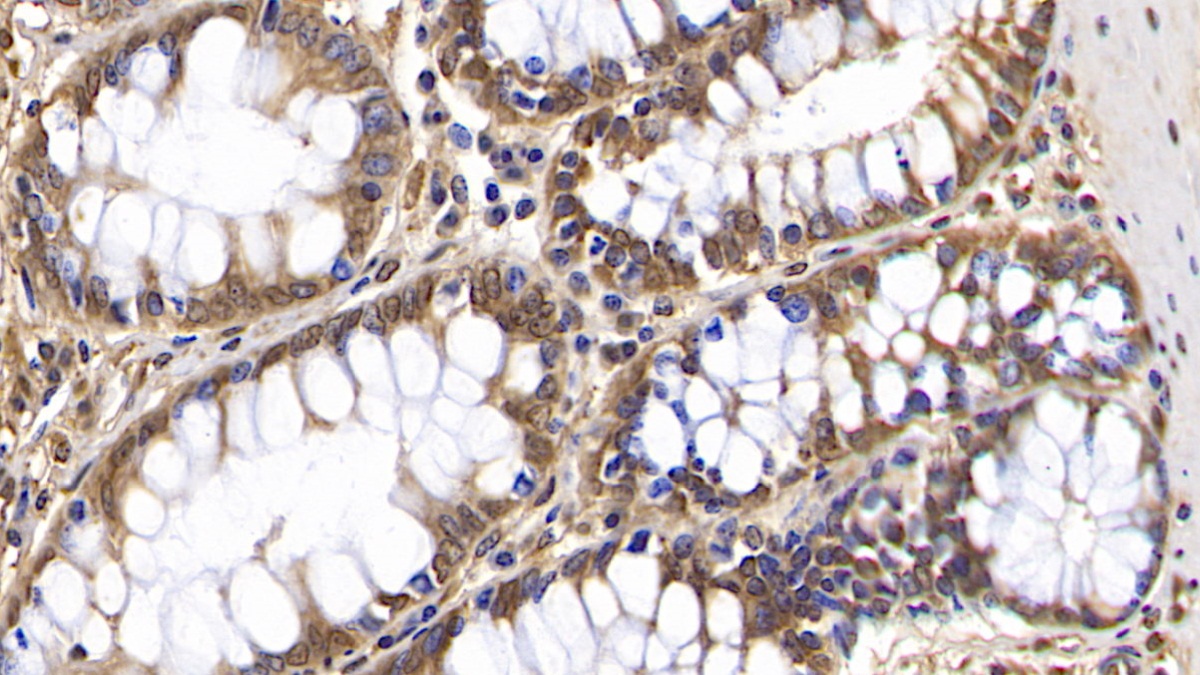 Monoclonal Antibody to 2',5'-Oligoadenylate Synthetase 2 (OAS2)