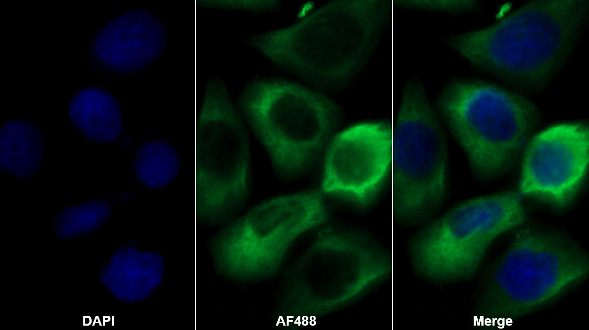 Monoclonal Antibody to Peroxiredoxin 2 (PRDX2)