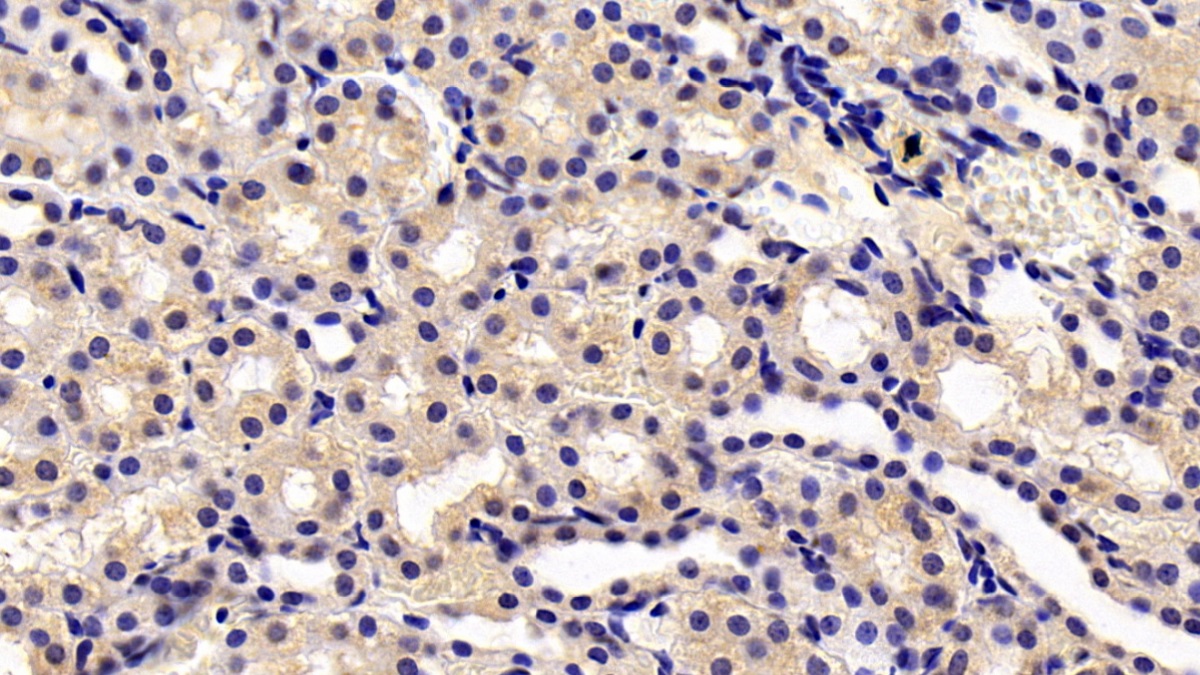 Monoclonal Antibody to Transient Receptor Potential Cation Channel Subfamily M, Member 4 (TRPM4)