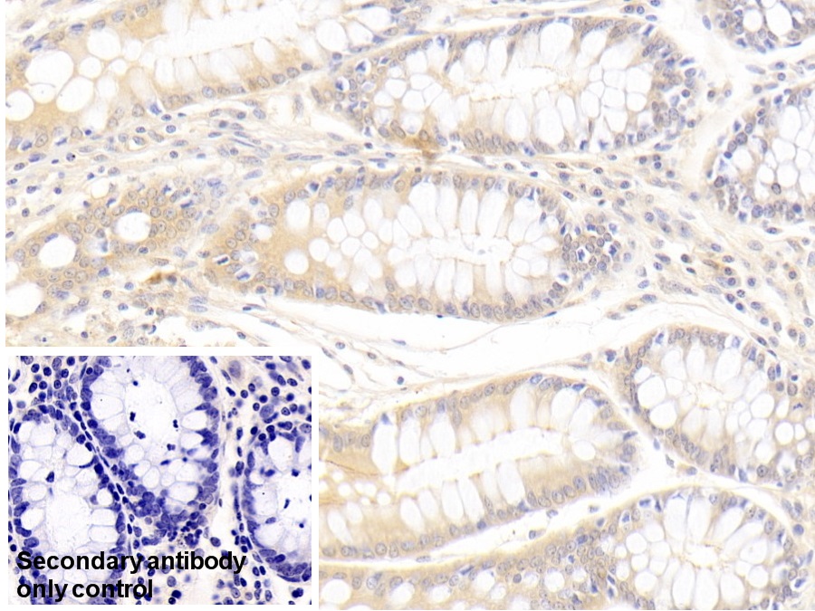 Monoclonal Antibody to Secreted Frizzled Related Protein 4 (SFRP4)