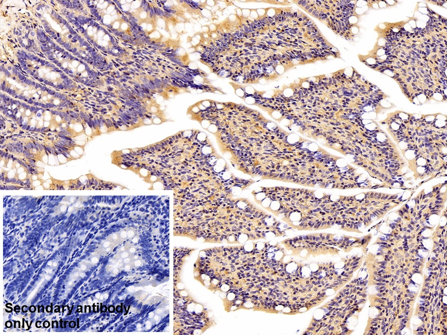 Monoclonal Antibody to Secreted Frizzled Related Protein 4 (SFRP4)