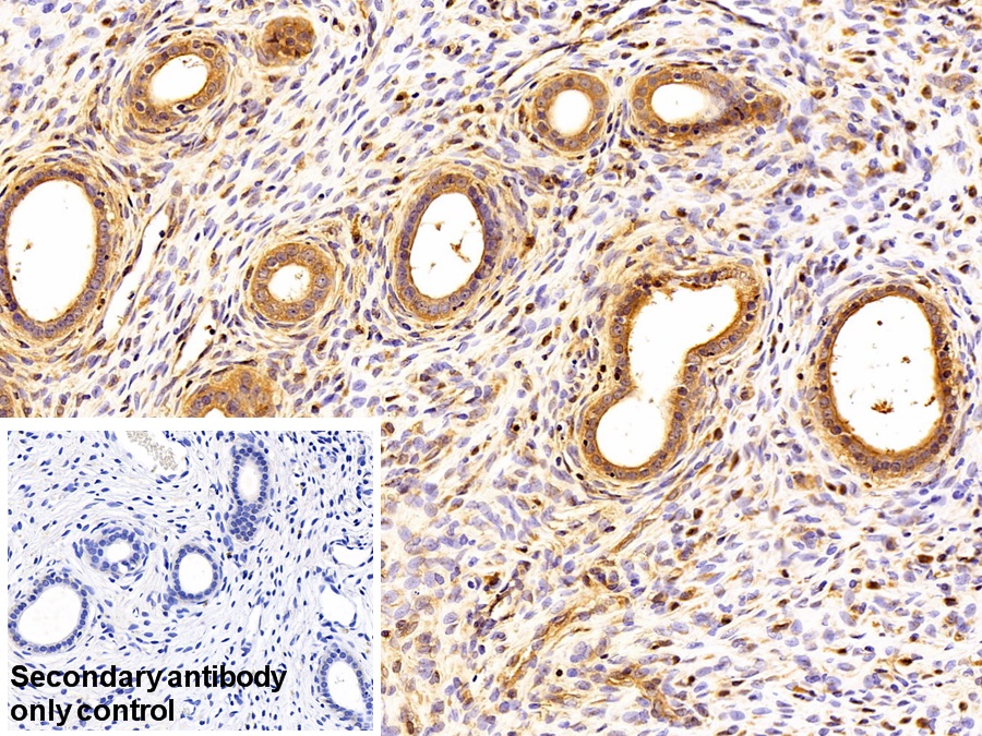 Monoclonal Antibody to Secreted Frizzled Related Protein 4 (SFRP4)