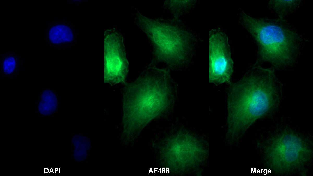 Monoclonal Antibody to Secreted Frizzled Related Protein 4 (SFRP4)