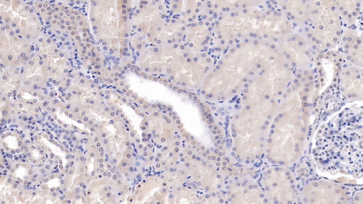 Monoclonal Antibody to Secreted Frizzled Related Protein 1 (SFRP1)