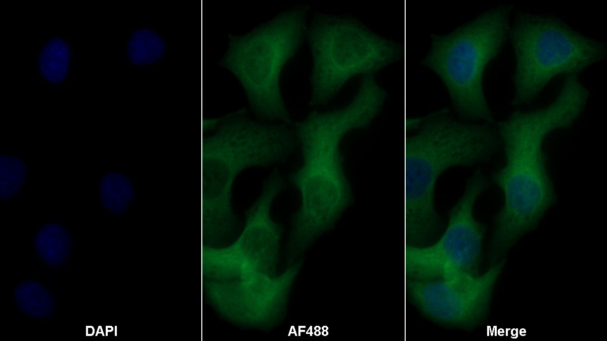 Monoclonal Antibody to Secreted Frizzled Related Protein 1 (SFRP1)