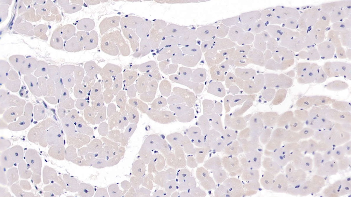 Monoclonal Antibody to Secreted Frizzled Related Protein 1 (SFRP1)