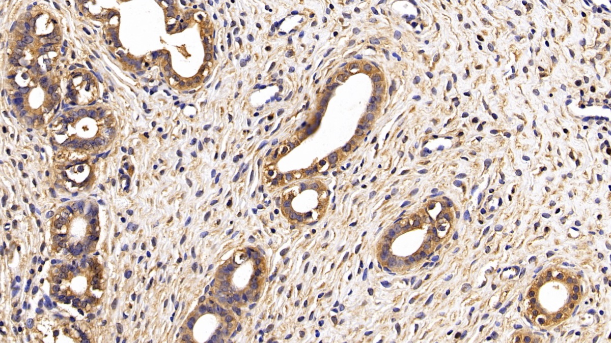 Monoclonal Antibody to Secreted Frizzled Related Protein 1 (SFRP1)