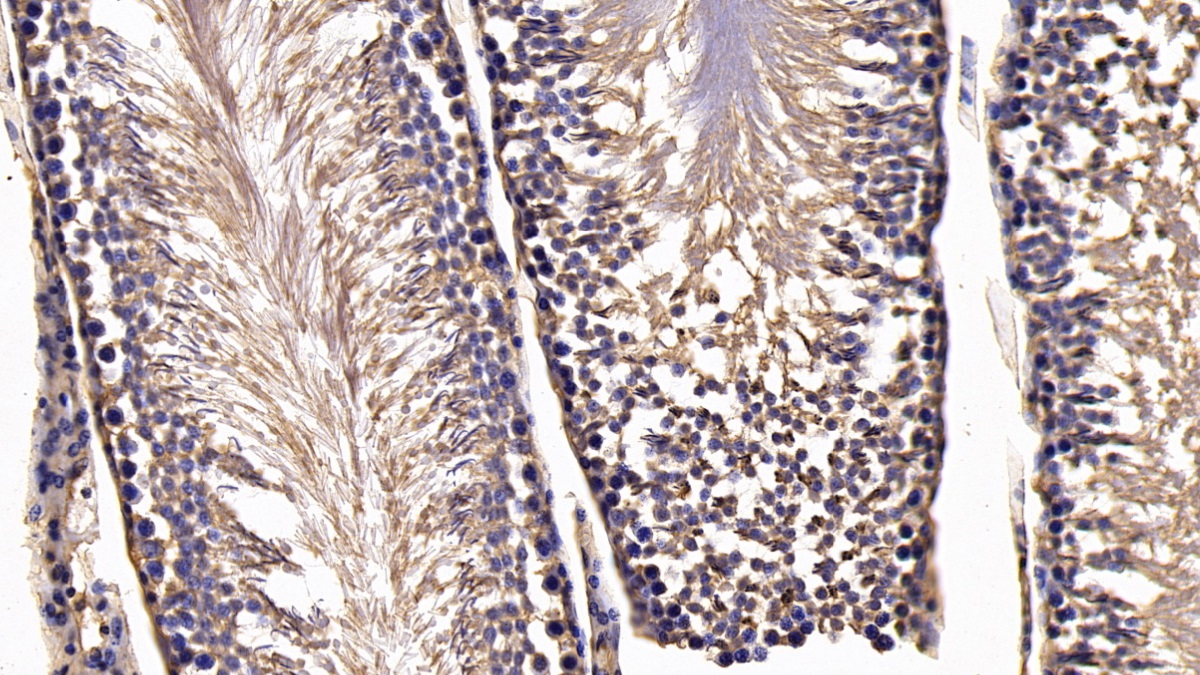 Monoclonal Antibody to Secreted Frizzled Related Protein 1 (SFRP1)