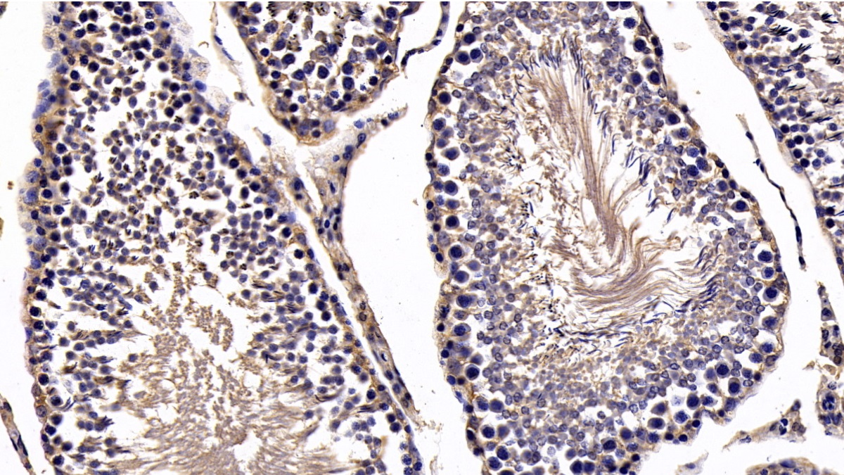 Monoclonal Antibody to Secreted Frizzled Related Protein 1 (SFRP1)