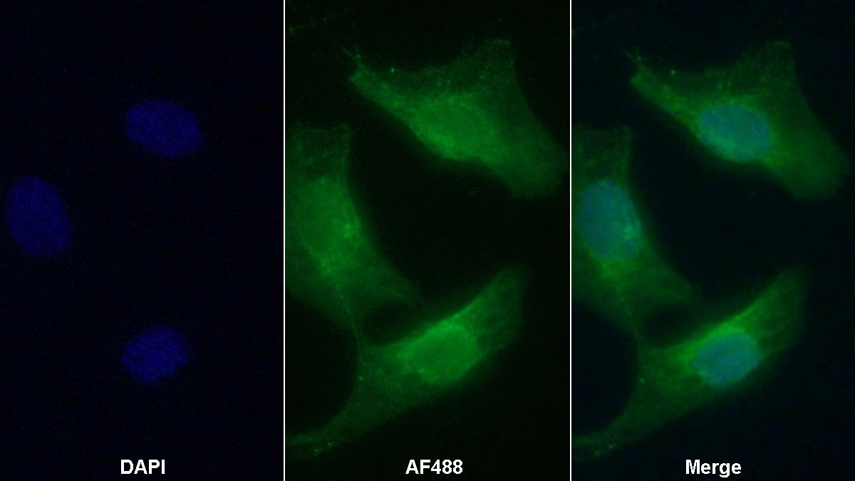 Monoclonal Antibody to Secreted Frizzled Related Protein 1 (SFRP1)