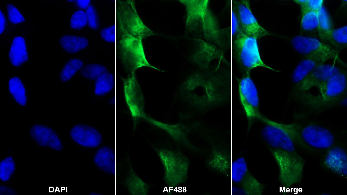 Monoclonal Antibody to Purinergic Receptor P2X, Ligand Gated Ion Channel 7 (P2RX7)