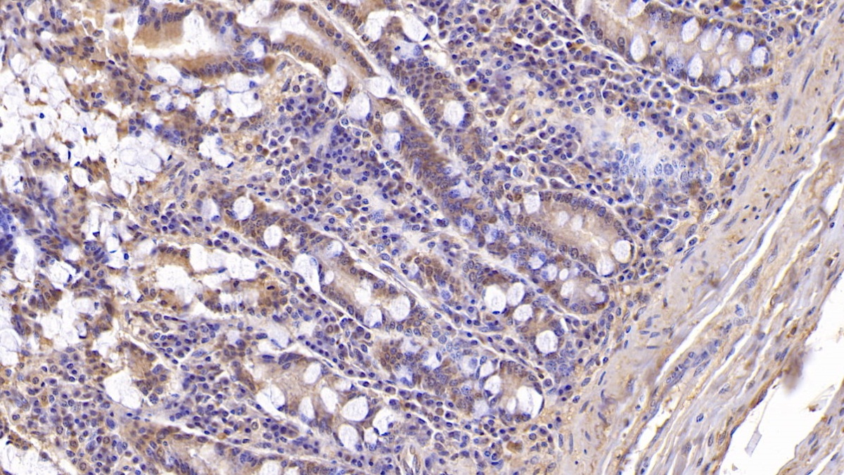 Monoclonal Antibody to Aspartate Beta Hydroxylase (ASPH)