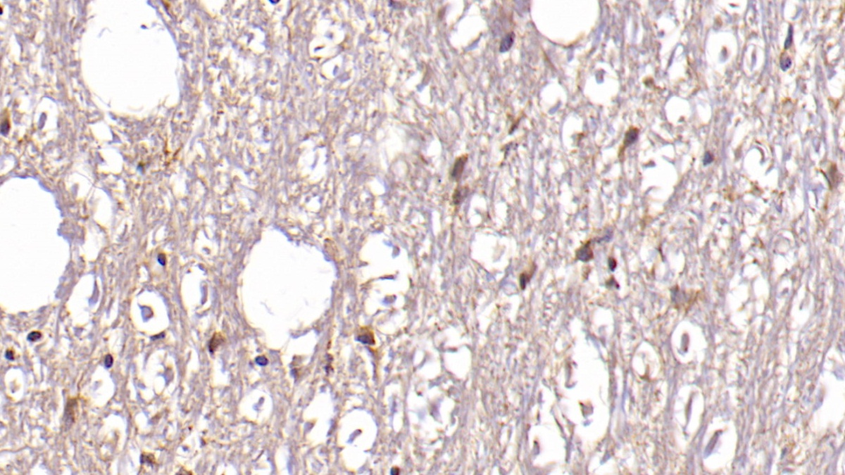 Monoclonal Antibody to Aspartate Beta Hydroxylase (ASPH)