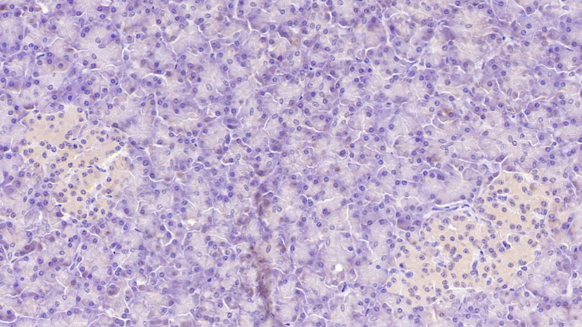 Monoclonal Antibody to Aspartate Beta Hydroxylase (ASPH)