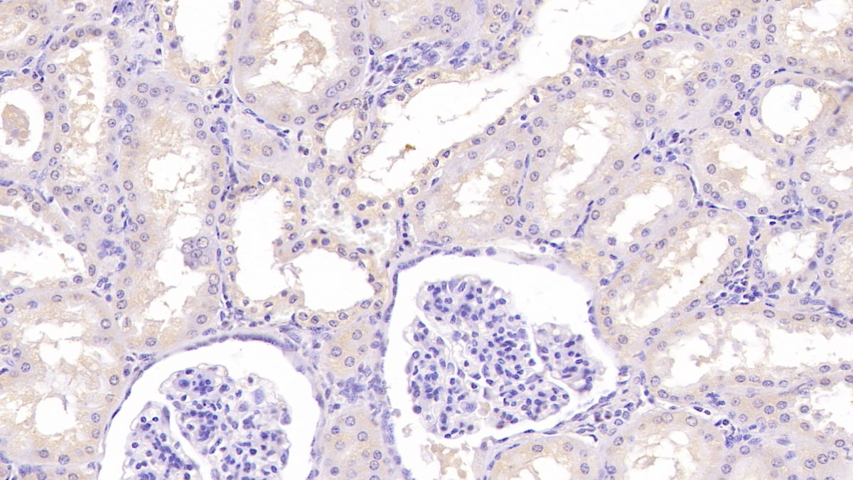 Monoclonal Antibody to Aspartate Beta Hydroxylase (ASPH)