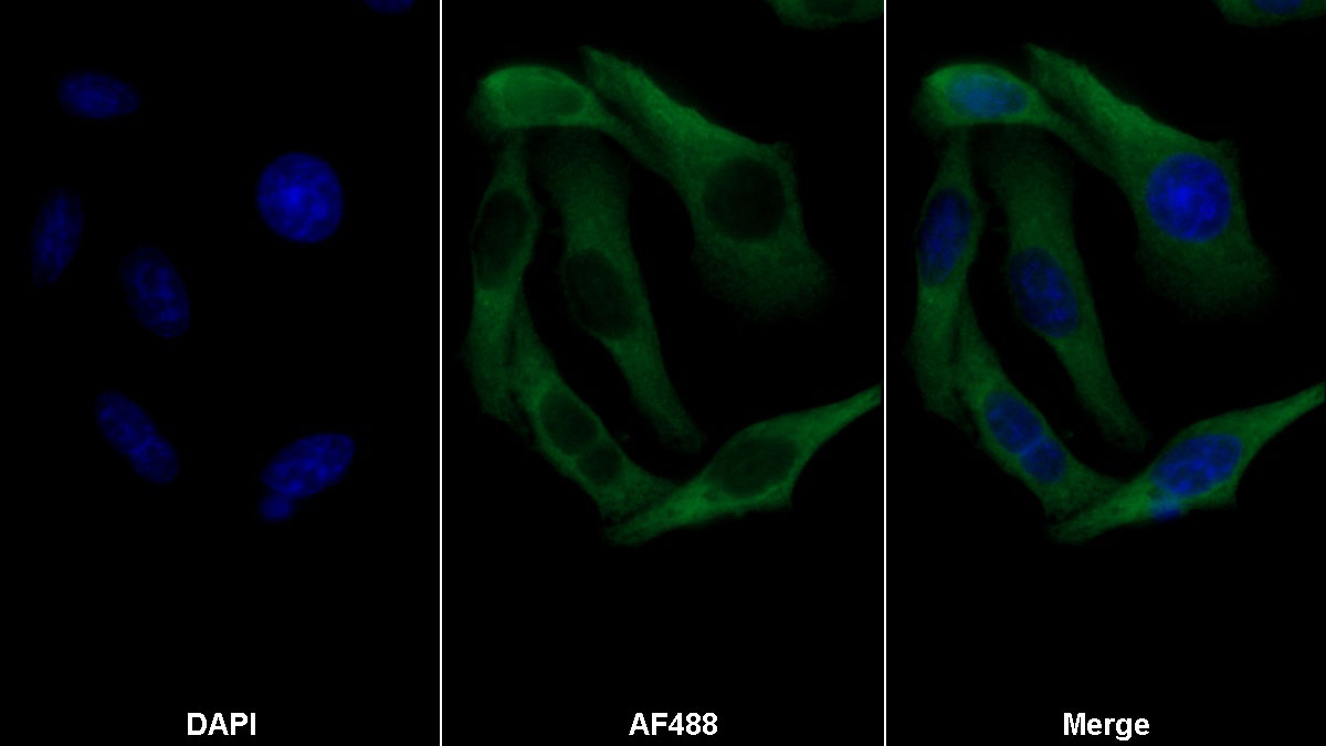 Monoclonal Antibody to Aspartate Beta Hydroxylase (ASPH)