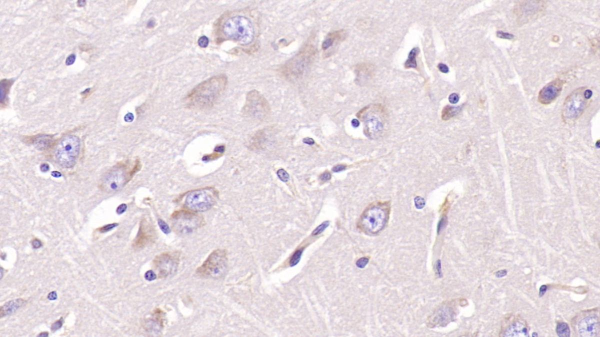 Monoclonal Antibody to Aspartate Beta Hydroxylase (ASPH)