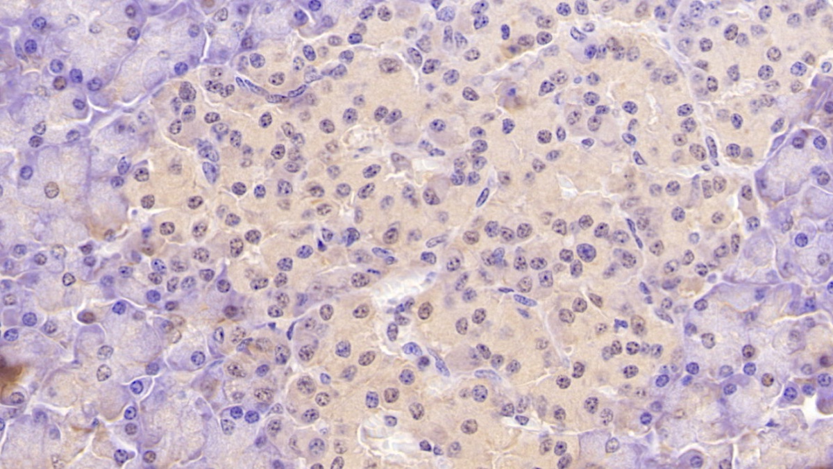 Monoclonal Antibody to Aspartate Beta Hydroxylase (ASPH)