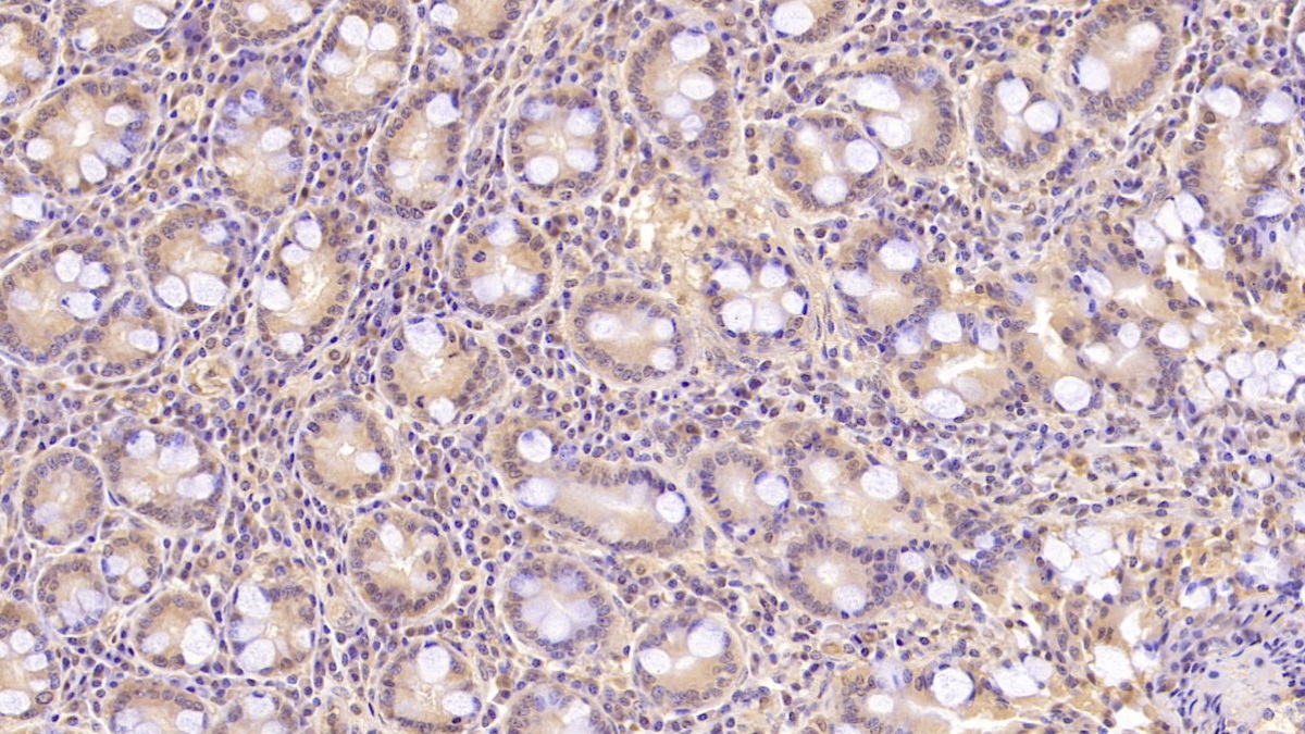 Monoclonal Antibody to Aspartate Beta Hydroxylase (ASPH)