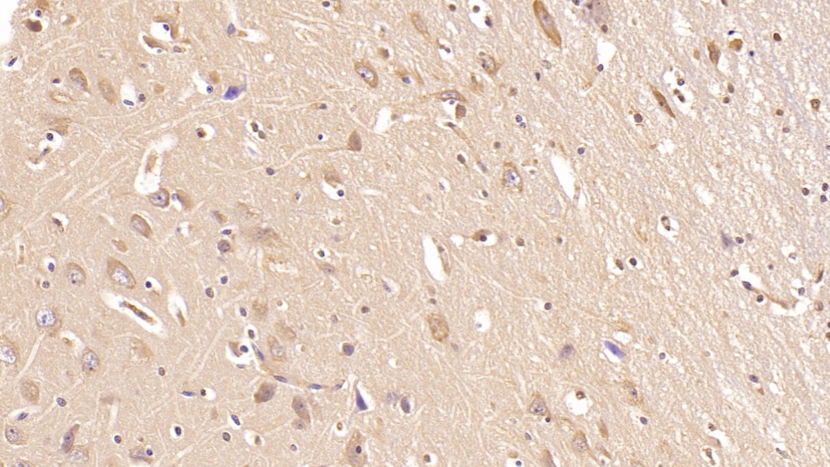 Monoclonal Antibody to Aspartate Beta Hydroxylase (ASPH)