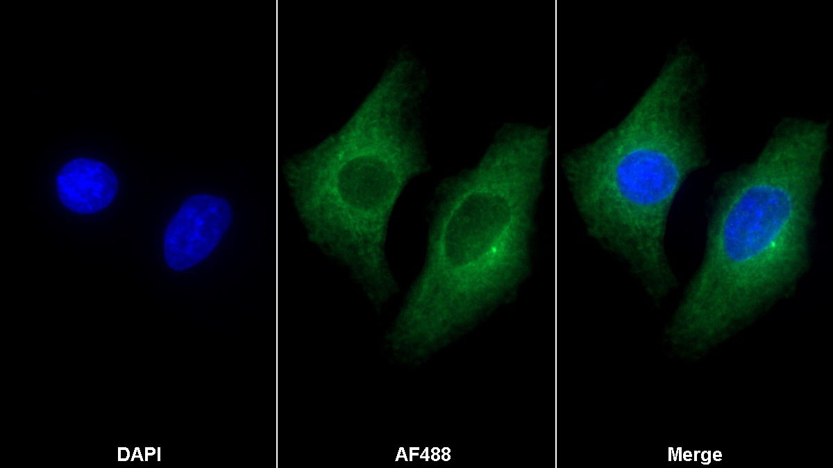 Monoclonal Antibody to Aspartate Beta Hydroxylase (ASPH)