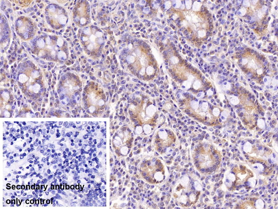 Monoclonal Antibody to Aspartate Beta Hydroxylase (ASPH)