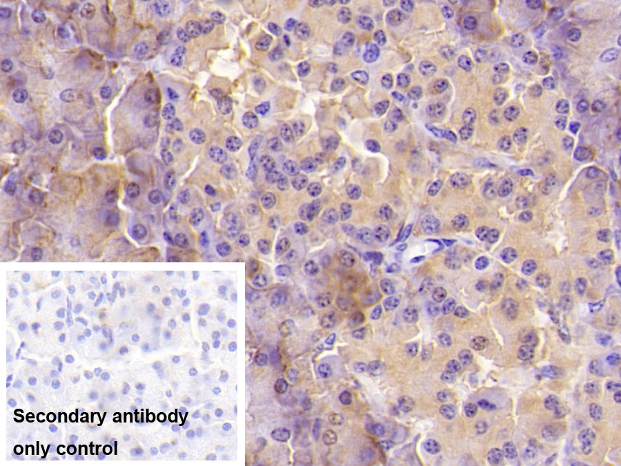 Monoclonal Antibody to Aspartate Beta Hydroxylase (ASPH)