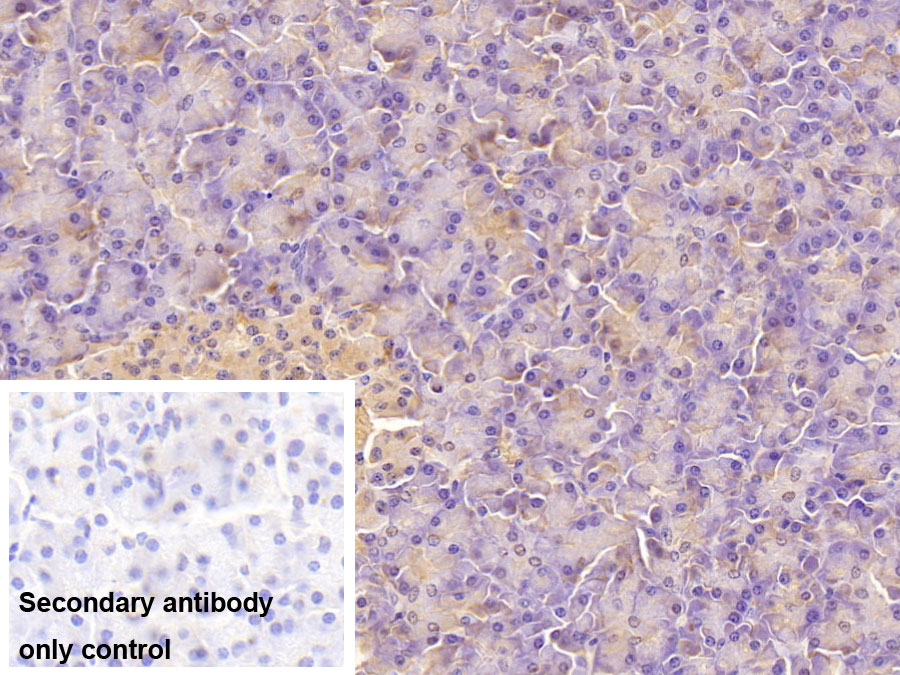 Monoclonal Antibody to Aspartate Beta Hydroxylase (ASPH)