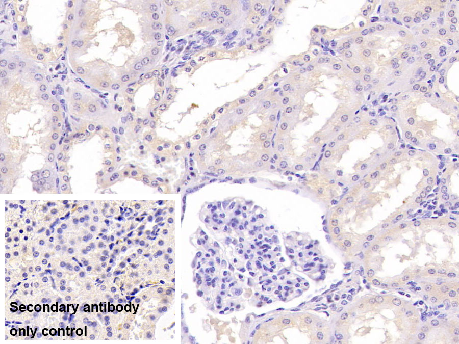 Monoclonal Antibody to Aspartate Beta Hydroxylase (ASPH)