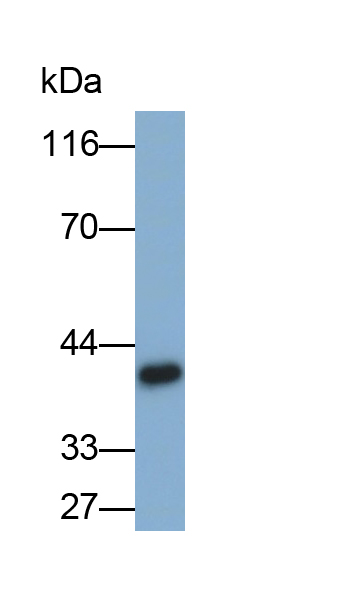 Monoclonal Antibody to Cysteine Rich Protein, Angiogenic Inducer 61 (CYR61)