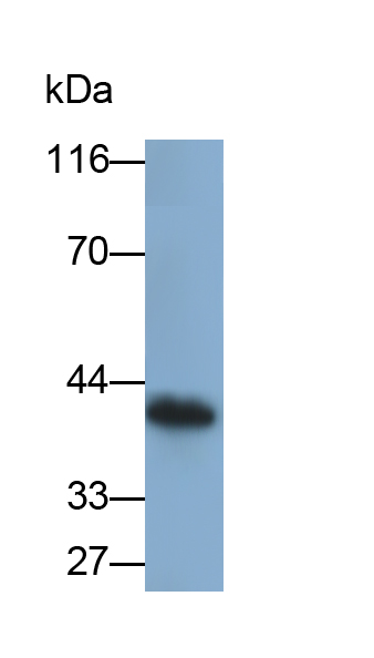 Monoclonal Antibody to Cysteine Rich Protein, Angiogenic Inducer 61 (CYR61)