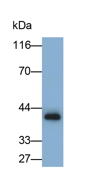 Monoclonal Antibody to Cysteine Rich Protein, Angiogenic Inducer 61 (CYR61)