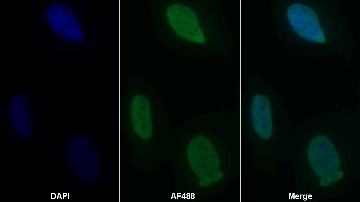 Monoclonal Antibody to Sex Determining Region Y Box Protein 11 (SOX11)