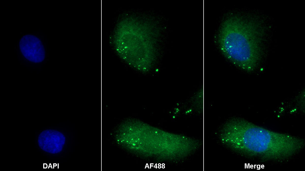 Monoclonal Antibody to Sex Determining Region Y Box Protein 11 (SOX11)