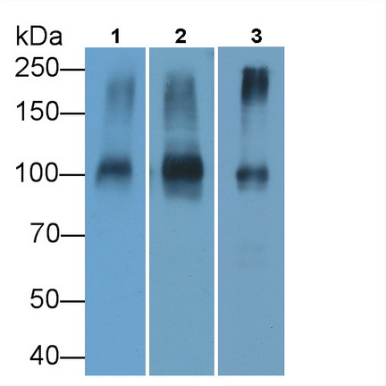 Monoclonal Antibody to ATPase, Na+/K+ Transporting Alpha 1 Polypeptide (ATP1a1)