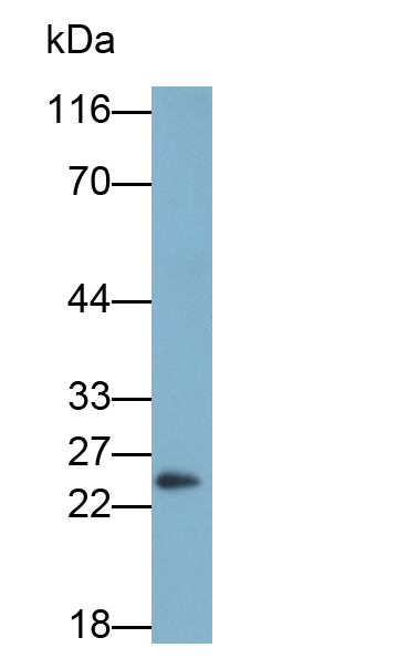 Monoclonal Antibody to Calbindin (CALB)