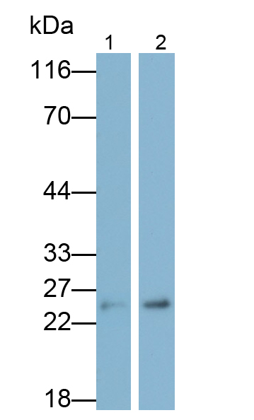 Monoclonal Antibody to Calbindin (CALB)