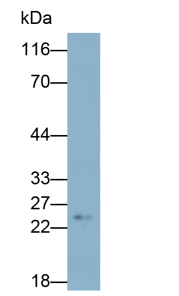 Monoclonal Antibody to Calbindin (CALB)