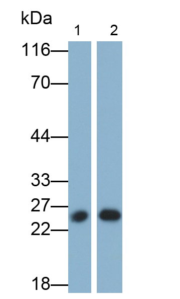 Monoclonal Antibody to Calbindin (CALB)