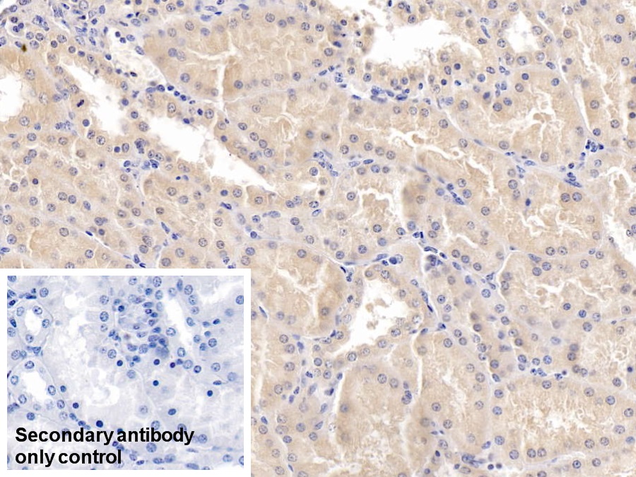 Monoclonal Antibody to Microtubule Associated Protein RP/EB Family, Member 1 (MAPRE1)