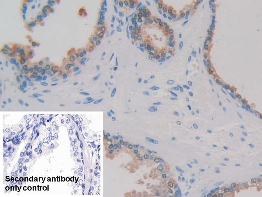 Monoclonal Antibody to Microtubule Associated Protein RP/EB Family, Member 1 (MAPRE1)