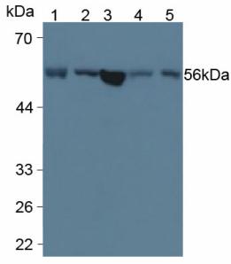 Monoclonal Antibody to Lysophosphatidylcholine Acyltransferase 3 (LPCAT3)