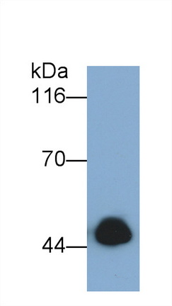 Monoclonal Antibody to Transcobalamin I (TCN1)