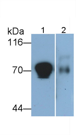 Monoclonal Antibody to Transcobalamin I (TCN1)