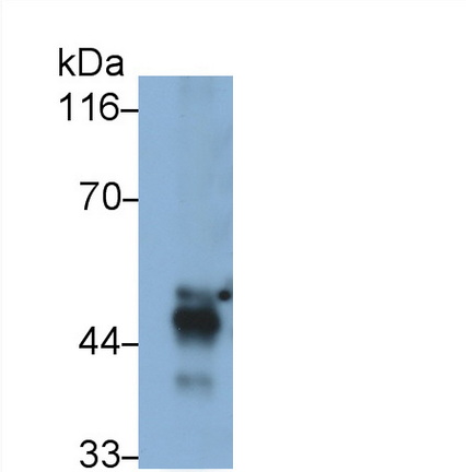 Monoclonal Antibody to Transcobalamin I (TCN1)