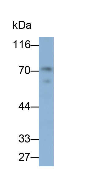 Monoclonal Antibody to Transcobalamin I (TCN1)