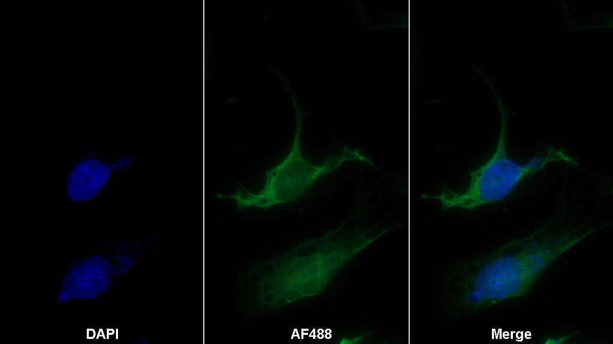 Monoclonal Antibody to Transcobalamin I (TCN1)