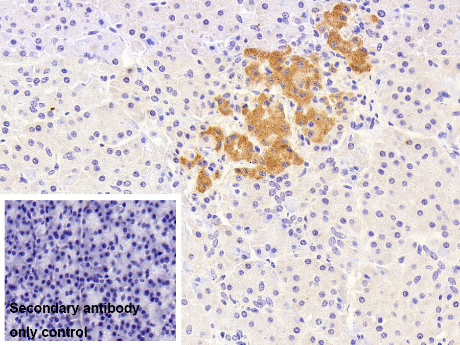 Monoclonal Antibody to Transcobalamin II, Macrocytic Anemia (TCN2)