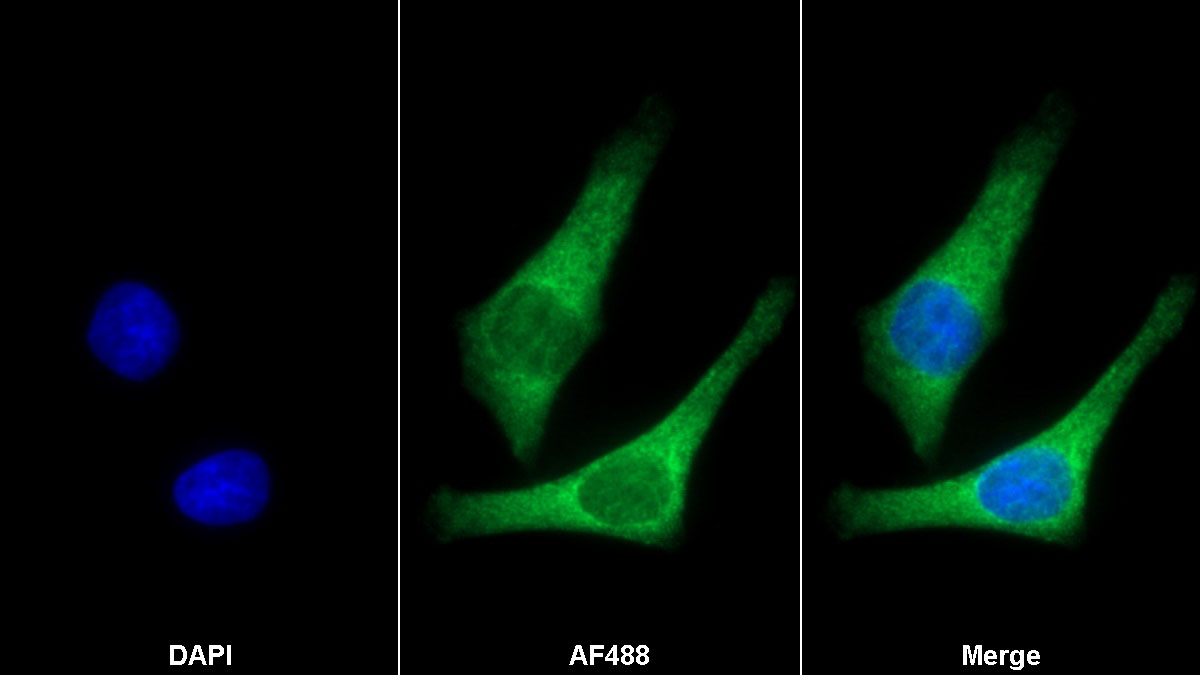 Monoclonal Antibody to Periostin (POSTN)