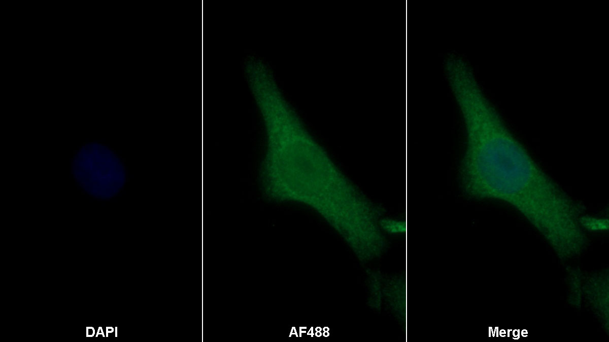 Monoclonal Antibody to Periostin (POSTN)